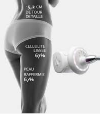 Cure de 10 Séances de 40 min image